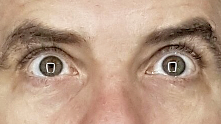 Прогнозировать собственные инфаркты и инсульты научат